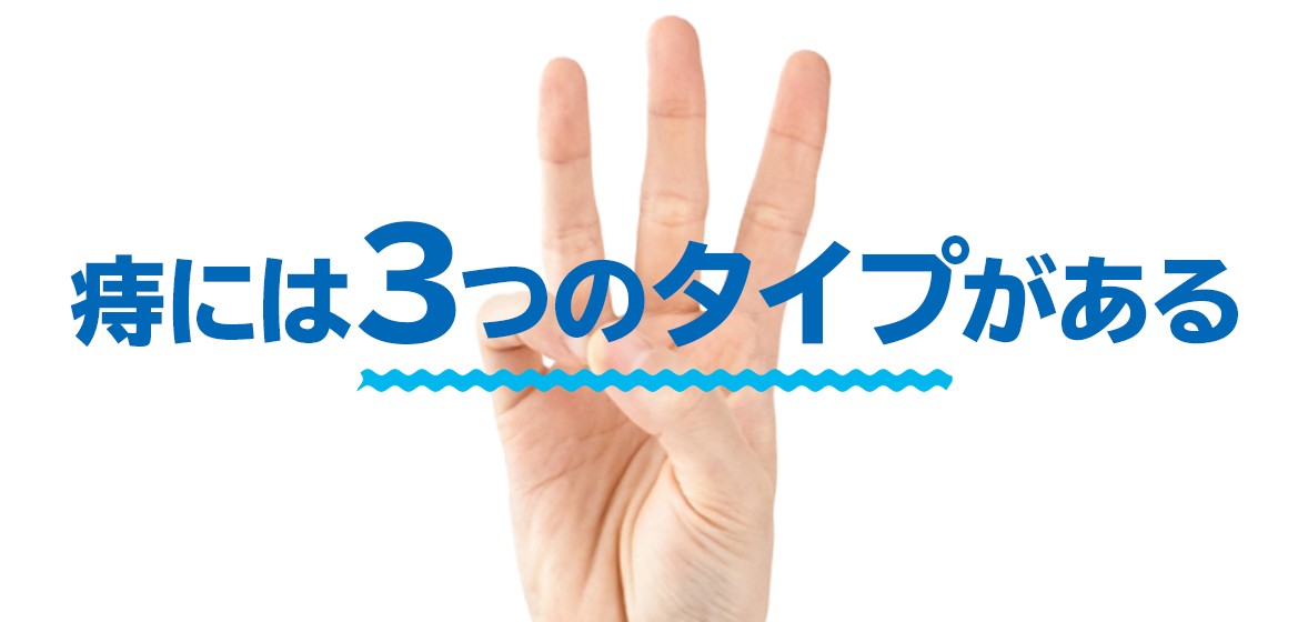 痔には3つのタイプがある